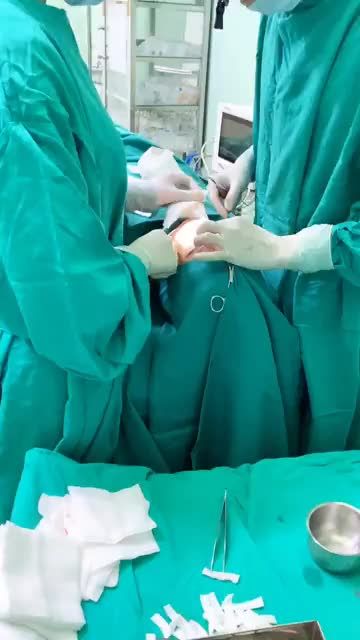 CẬN CẢNH DÁNG MŨI CẤU TRÚC S-LINE SAU NÂNG