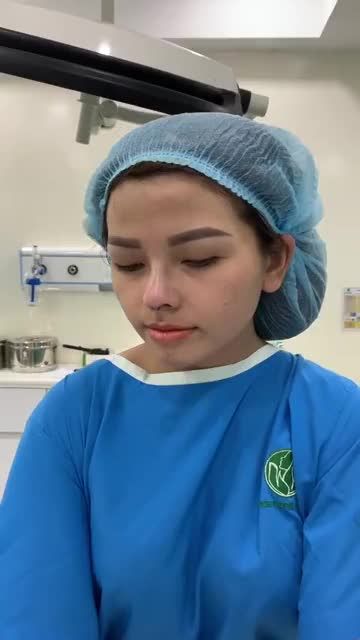 CẬN CẢNH DÁNG MŨI NGAY SAU THỰC HIỆN