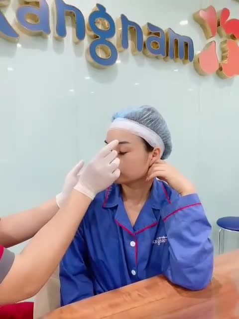Cận cảnh quá trình bác sĩ thực hiện thăm khám và đo vẽ nâng mũi