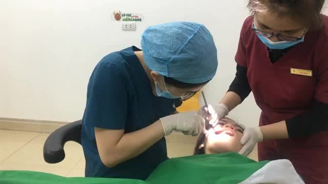 Cấy 4 minivis để hỗ trợ cho quá trình niềng răng tại Nha Khoa Thuỳ Anh.