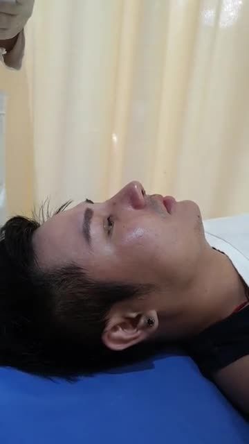 Chàng ca sĩ điển trai Nâng mũi đẹp mọi góc nhìn
