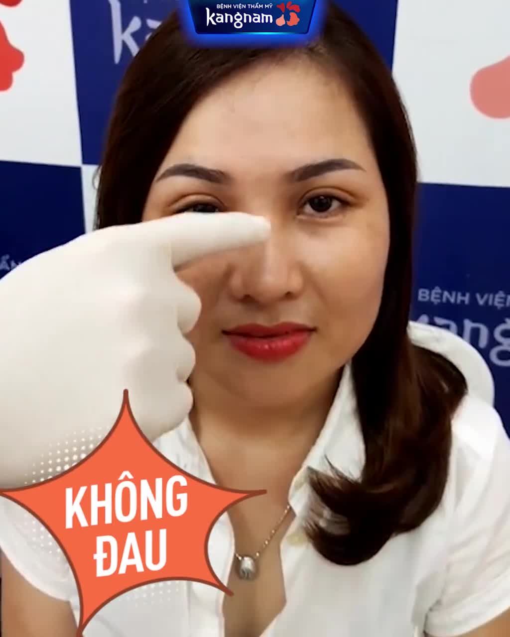 Chỉ CẮT MÍ + NÂNG MŨI SANG hẳn khuôn mặt