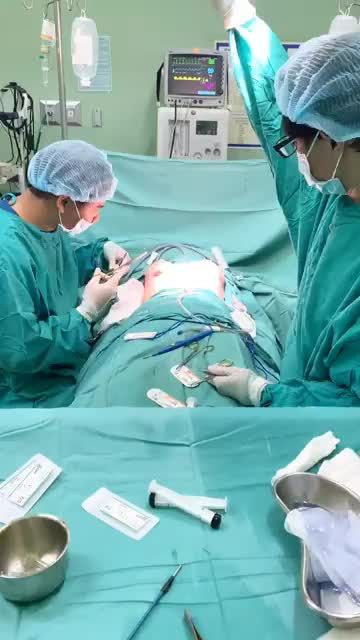Chỉ còn 4 ngày ưu đãi cuối cũng dành cho dòng túi Mentor kết hợp tạo khe ngực, nhanh tay đăng ký