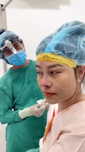 Chồng cực kỳ hài lòng với dáng mũi sau nâng của vợ