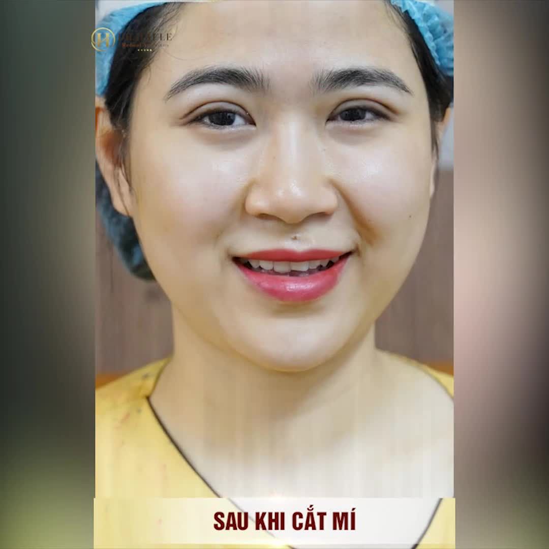 Chớp mắt 1 cái có ngay mí xinh.
