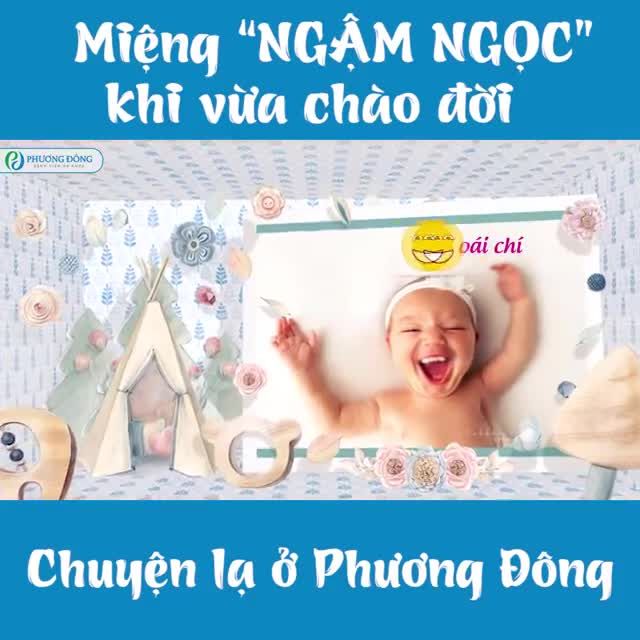 Chuyện lạ Phương Đông: Bé chào đời với chiếc răng "chất chơi"