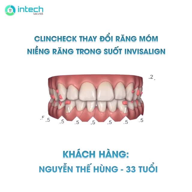 CLINCHECK KHÁCH HÀNG NGUYỄN THẾ HÙNG