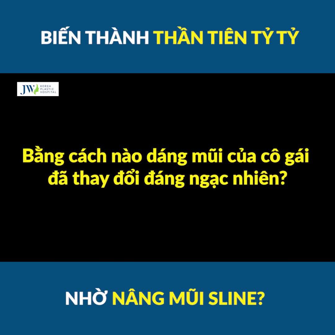 Cô gái có chiếc Mũi BẸT TẸT THẸT LẸT biến thành THẦN TIÊN TỶ TỶ thanh tú nhờ NÂNG MŨI SLINE