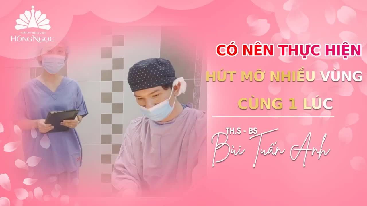 CÓ NÊN THỰC HIỆN HÚT MỠ NHIỀU VÙNG CÙNG 1 LÚC?