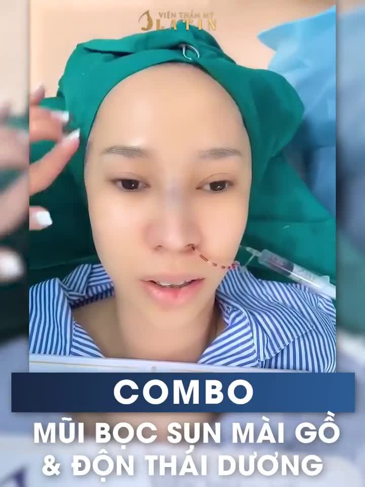 COMBO MŨI BỌC SỤN MÀI GỒ + ĐỘN THÁI DƯƠNG