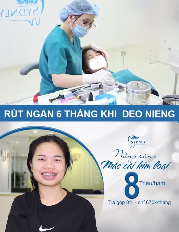 Đã có hàng triệu nụ cười Việt được hoàn thiện hơn với mắc cài kim loại, còn bạn thì sao