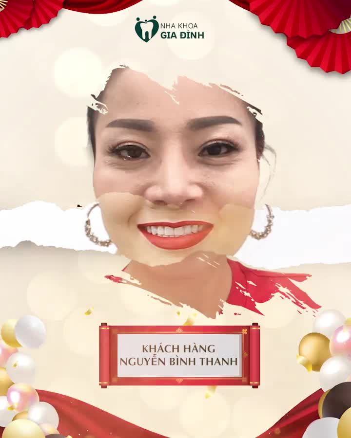 DÁN SỨ VENEER: HÚT ÁNH NHÌN – TỰ TIN TỎA SÁNG