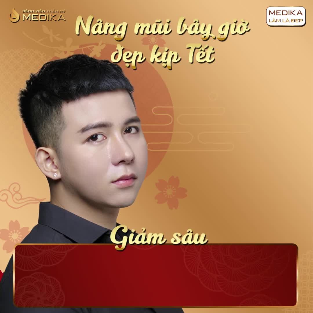 DÁNG MŨI CAO TÂY, CHUẨN TỈ LỆ CỰC KÌ ĐƠN GIẢN