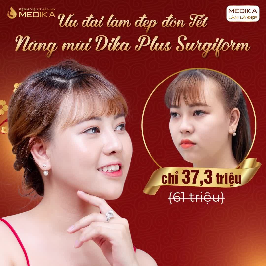 DÁNG MŨI CHARM CAO XINH, TỰ NHIÊN TÔN VINH GƯƠNG MẶT THÊM SẮC NÉT