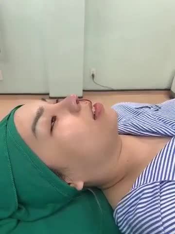 Dáng mũi Latin mềm mại tự nhiên, cải thiện ngay các khuyết điểm: