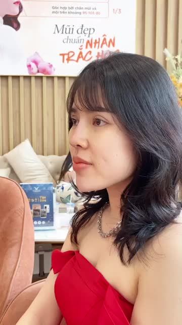 Dáng mũi vào form chỉ sau 8 ngày