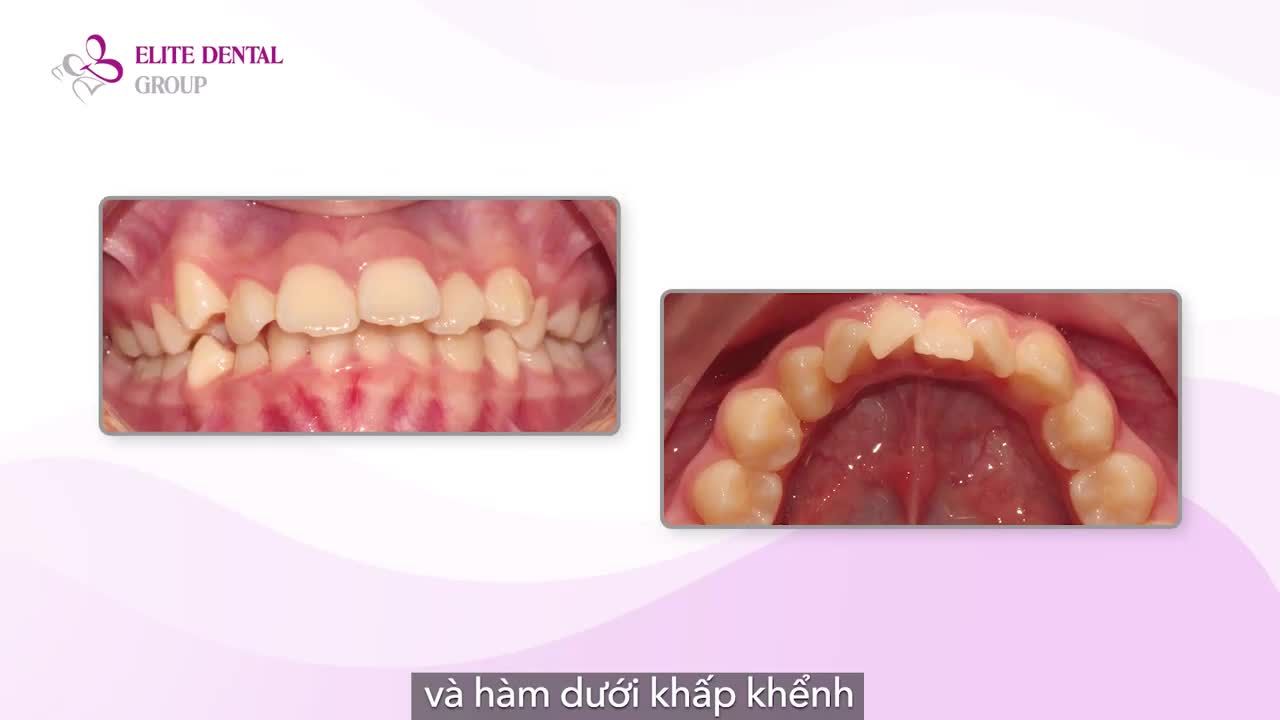 Dành năm tháng chờ ngày nụ cười xứng đáng