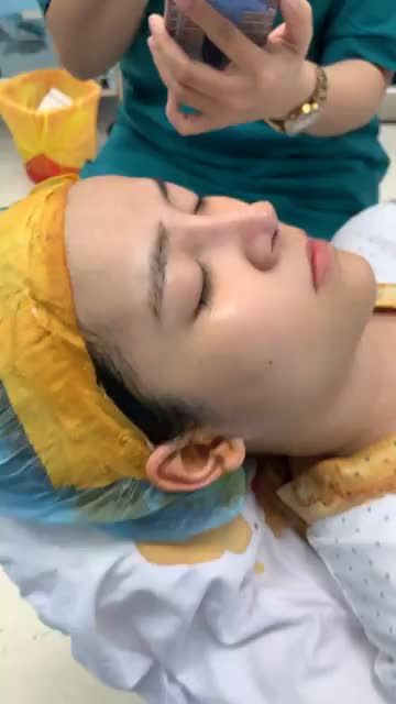 Đầu mũi ngắn, sóng thấp thay đổi thế nào sau khi nâng mũi cấu trúc cao tự nhiên?