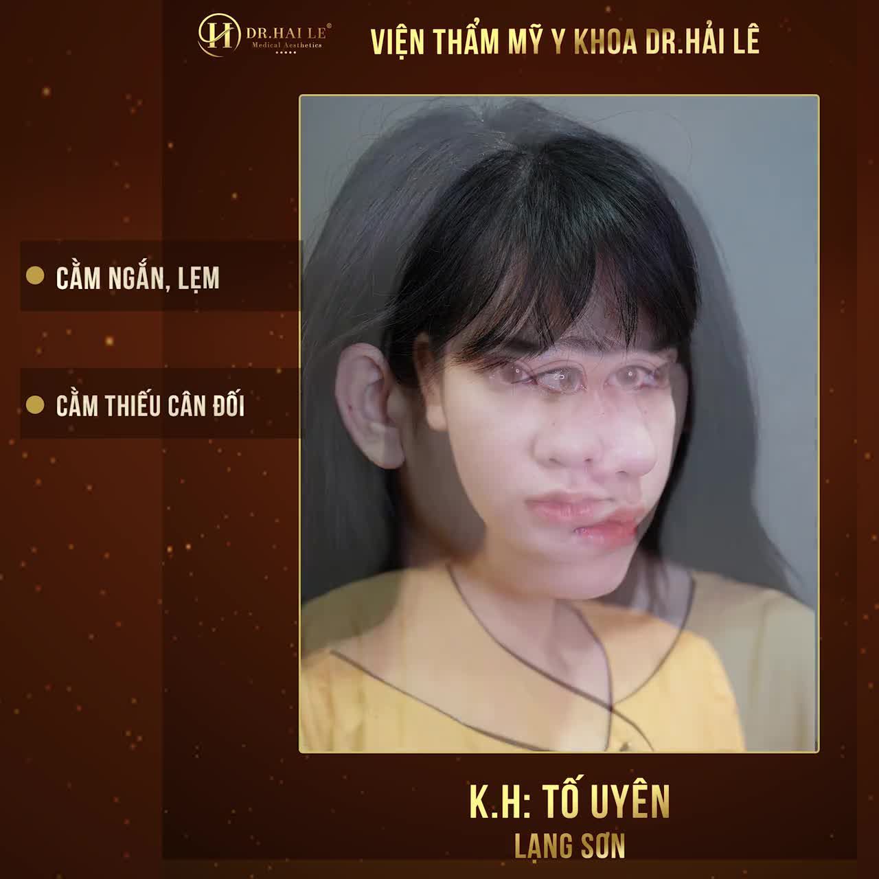 DIỄN VIÊN TỐ UYÊN: “MỘT KẾT QUẢ ĐỘN CẰM TỰ NHIÊN KHIẾN MÌNH RẤT HÀI LÒNG”