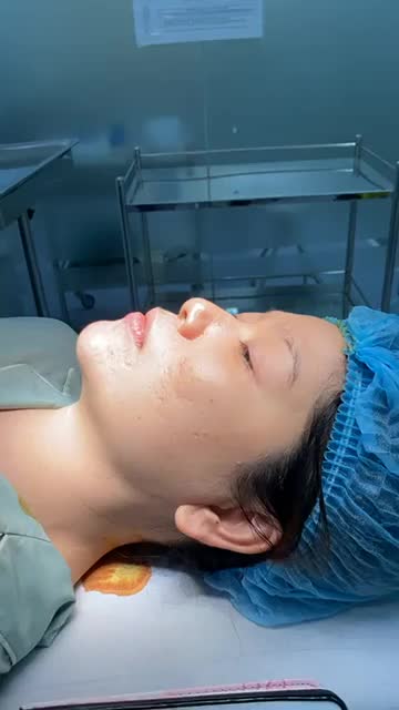 ĐỘN CẰM TẠO HÌNH TỈ LỆ VÀNG CHO GƯƠNG MẶT