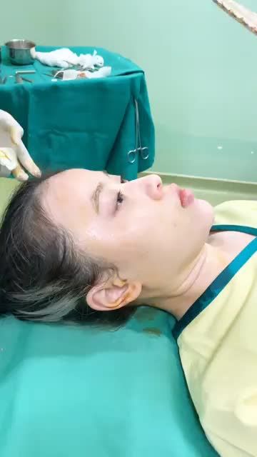 Độn cằm Vline Mỹ giúp chị em nhanh chóng sở hữu khuôn mặt thanh thoát và xinh đẹp hơn