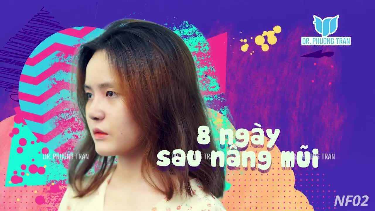 ĐỘNG LỰC ĐỂ CÁC BẠN ĐI NÂNG MŨI LÀ ĐÂY!
