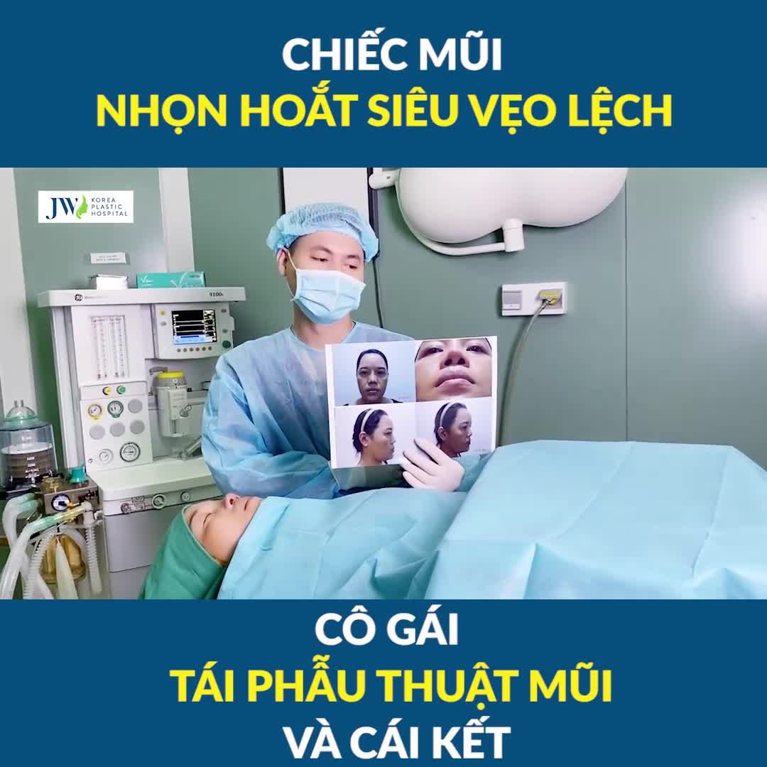 GÁI XINH có chiếc MŨI XẤU vẹo lệch THAY ĐỔI NGOẠN MỤC nhờ điều này