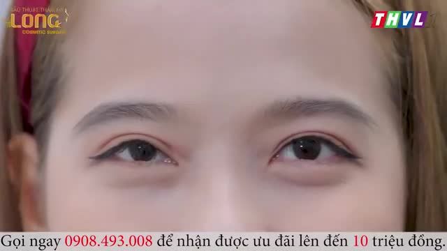 GIẢI CỨU CA “MẮT YẾU CƠ”
