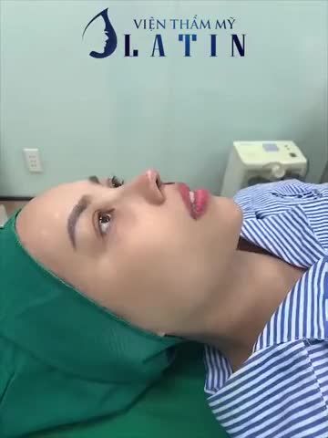 GIẢI CỨU MŨI HỎNG SAU 2H30’