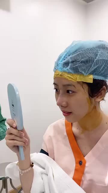 Gương mặt baby, trẻ trung sau nâng mũi