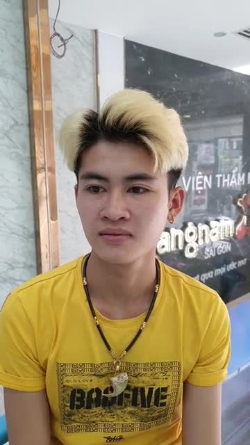 HÀM MÓM gây mất thẩm mỹ, hạn chế ăn nhai