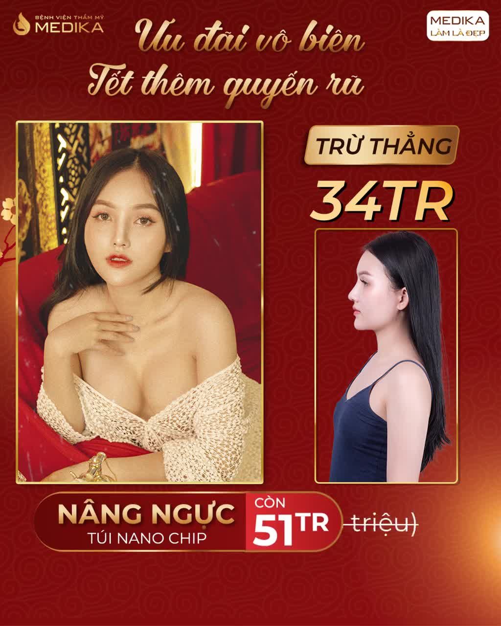 HẾT LÉP XẸP - ĐẸP HƠN, HOÀN THIỆN HƠN