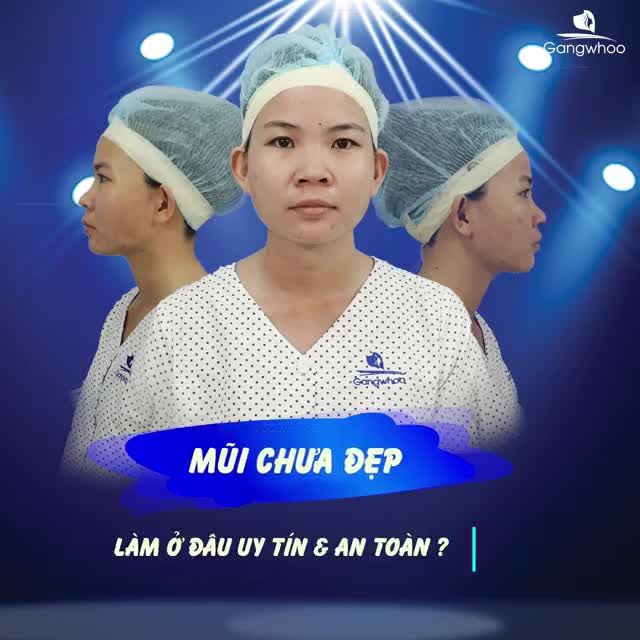 “HOÁ THIÊN NGA” CÙNG CHIẾC MŨI XINH ĐẸP TỰA SAO HÀN CHỈ VỚI 10 TRIỆU