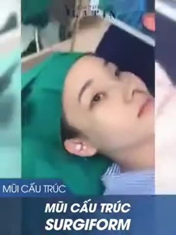 Kết quả ca mũi cấu trúc surgiform siêu xịn cải thiện dáng mũi thấp tẹt thành mũi cao thanh tú