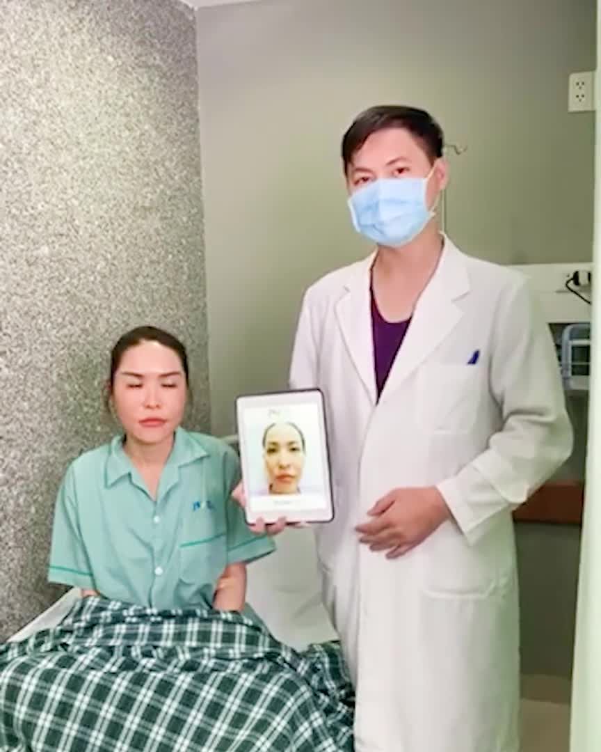 Kết quả CẤY MỠ MẶT, U40 trẻ hoá 20 TUỔI tức thì