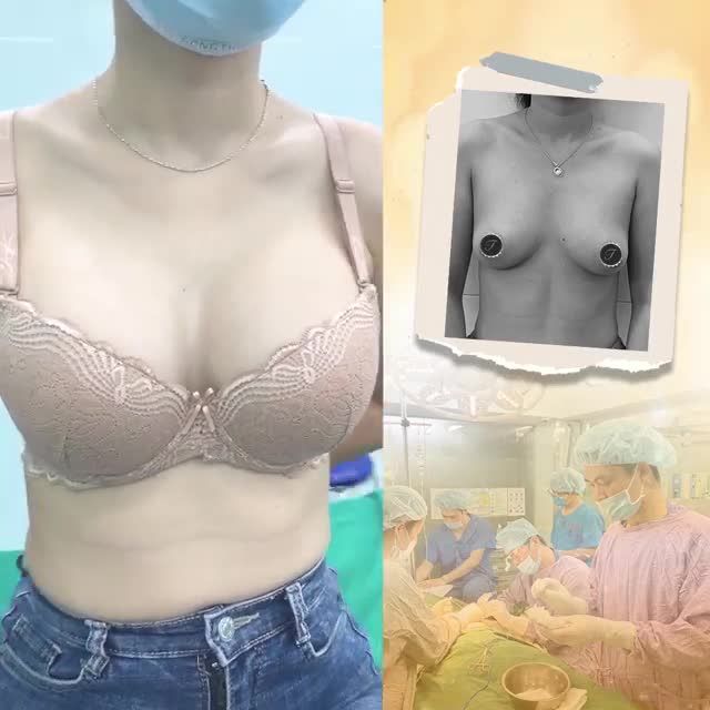 KẾT QUẢ NÂNG CẤP V1 SAU 3 THÁNG