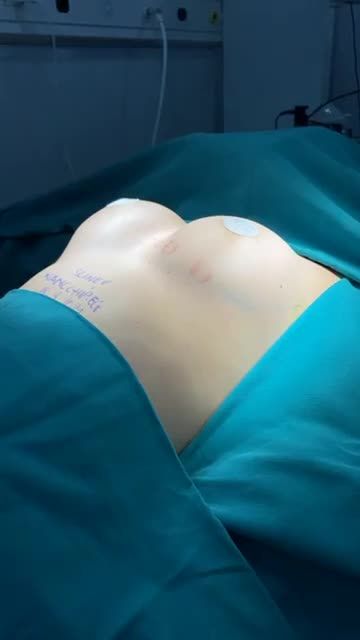KẾT QUẢ NÂNG CẤP VÒNG 1