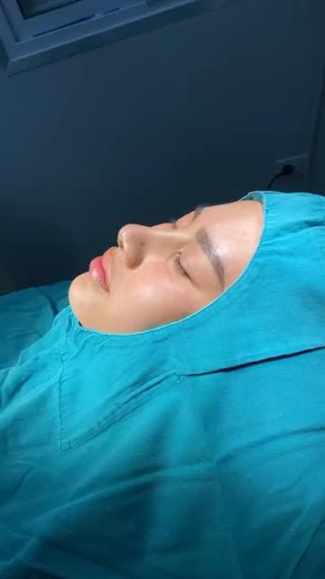 KẾT QUẢ NÂNG MŨI