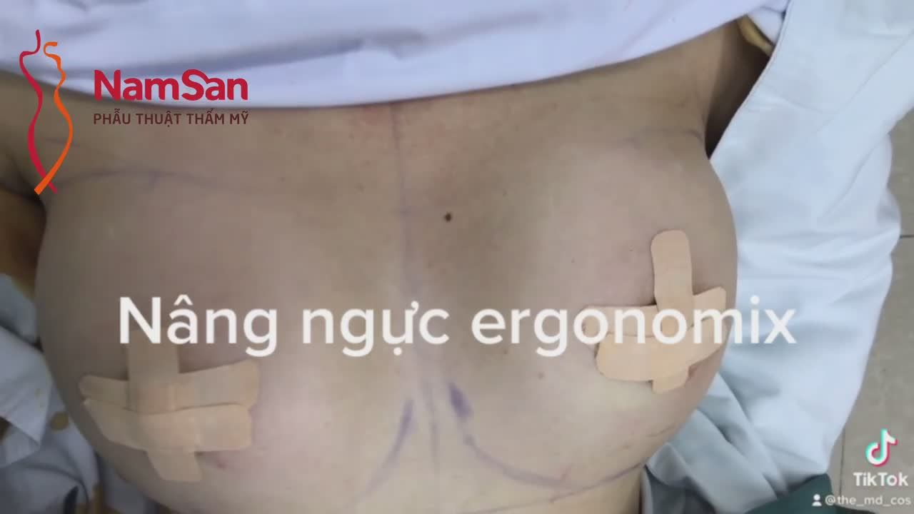 KẾT QUẢ NÂNG VÒNG 1