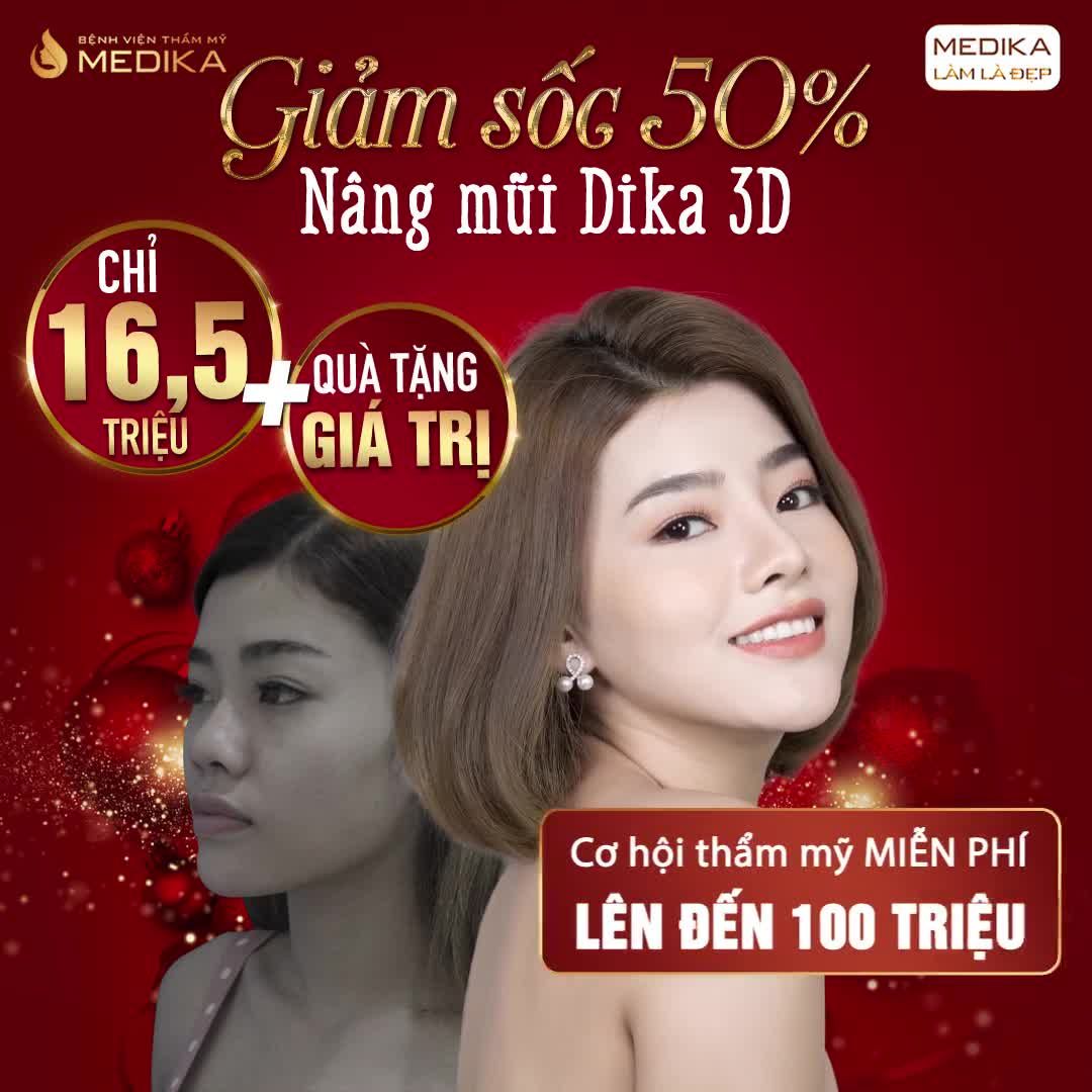 KẾT QUẢ SAU NÂNG MŨI DIKA 3D ĐẸP HƠN CẢ MONG ĐỢI