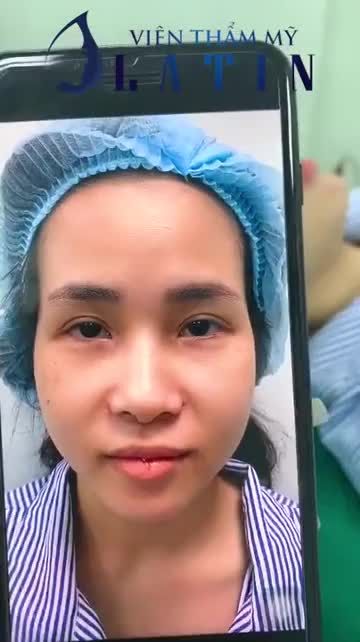 KẾT QUẢ VÀ CẢM NHẬN CỦA KHÁCH HÀNG SAU 1 TIẾNG ĐỘN THÁI DƯƠNG