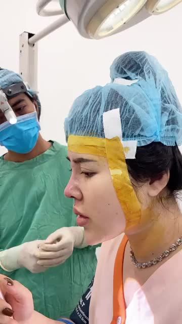 Khắc phục đầu mũi ngắn - da mũi mỏng chỉ sau 120 phút