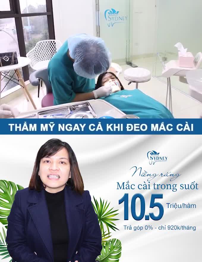 KHẮC PHỤC RĂNG KHẤP KHỂNH CÙNG MẮC CÀI PHA LÊ