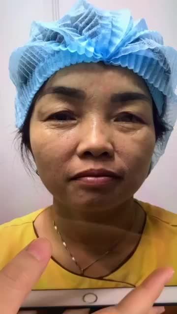 Khách hàng bất ngờ vì không nghĩ chỉ thay đổi nhỏ ở đôi mắt có thể giúp nhan sắc trẻ lại đến 10 tuổi