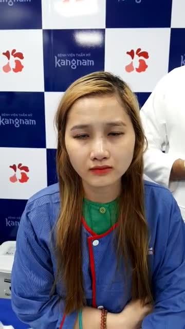 KHÁCH HÀNG NÂNG MŨI SLINE 4D CHỈNH XƯƠNG