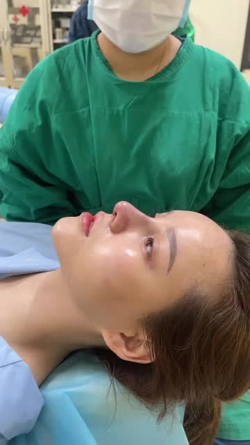 Khách hàng vừa nâng xong ca Nâng Mũi Cấu Trúc. Khách hàng “ruột” của Tuấn Linh vì “ ba đời” đều nâng mũi tại đây