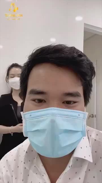 KHÁCH HÀNG YẾN NHI - TÁI KHÁM SAU 3 THÁNG NÂNG MŨI CẤU TRÚC SURGIFORM.