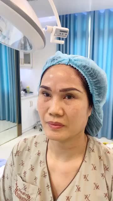 KHI MÍ MẮT CÓ QUÁ NHIỀU KHUYẾT ĐIỂM, DA CHÙNG NHIỀU NHƯNG KHÔNG THỂ XỬ LÝ BẰNG CẮT MÍ