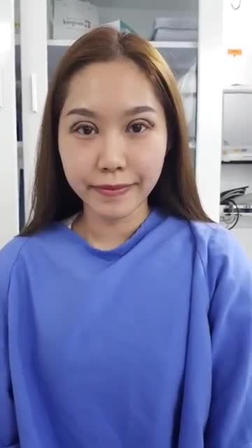 Không dám nhìn vào đôi mắt ấy Đôi mắt sau khi CẮT MÍ đẹp tuyệt vời