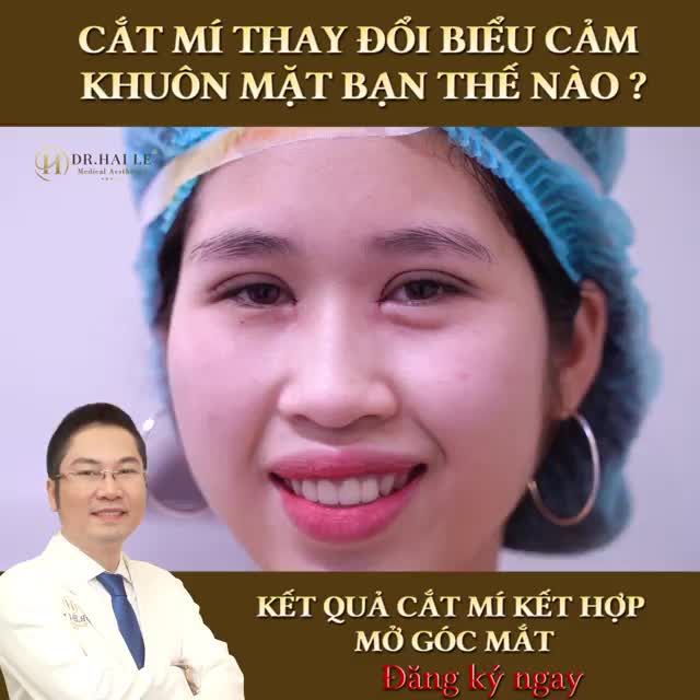 “Là phụ nữ ai muốn có mí nhỏ kém xinh đâu nào ?”